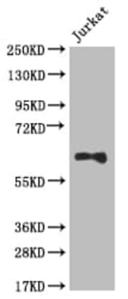 Glut3 Antibody (14B1), Novus Biologicals:Antibodies:Primary Antibodies