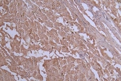 Glut2 Antibody (37E1), Novus Biologicals 100 &mu;L; Unconjugated:Antibodies,