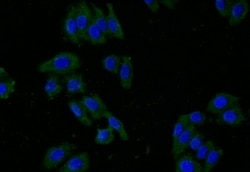 Glut2 Antibody (37E1), Novus Biologicals 100 &mu;L; Unconjugated:Antibodies,
