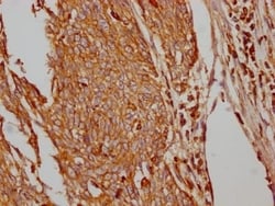 Glut1 Antibody (2E1), Novus Biologicals:Antibodies:Primary Antibodies
