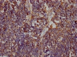 Glut1 Antibody (2E1), Novus Biologicals:Antibodies:Primary Antibodies