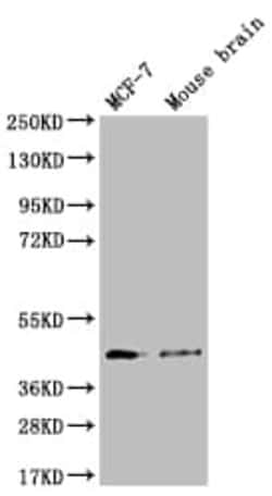 FATP4/SLC27A4 Antibody (11A1), Novus Biologicals:Antibodies:Primary Antibodies