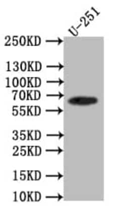 EAAT2/GLT1 Antibody (28F9), Novus Biologicals 50 &mu;L; Unconjugated:Antibodies,