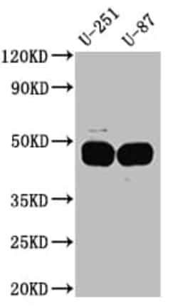Serpin E1/PAI-1 Antibody (10C3), Novus Biologicals 100 &mu;L; Unconjugated:Antibodies,