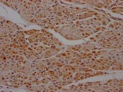 SDHB Antibody (7D12), Novus Biologicals:Antibodies:Primary Antibodies