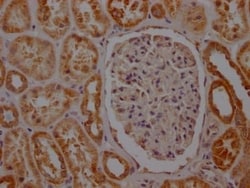 SDHB Antibody (7D12), Novus Biologicals:Antibodies:Primary Antibodies