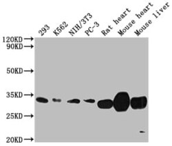 SDHB Antibody (7D12), Novus Biologicals:Antibodies:Primary Antibodies