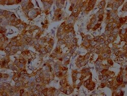 S100A9 Antibody (2E9), Novus Biologicals 100 &mu;L | Buy Online | Novus Biologicals | Fisher Scientific
