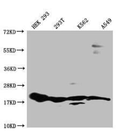 RPS19 Antibody (7E6), Novus Biologicals:Antibodies:Primary Antibodies