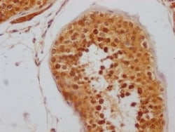 RNF20 Antibody (2H12), Novus Biologicals 100 &mu;L; Unconjugated:Antibodies,