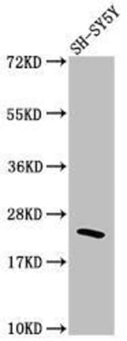 RhoA Antibody (1C11), Novus Biologicals 50 &mu;L; Unconjugated:Antibodies,