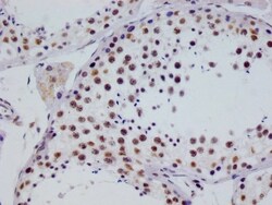 RGS6 Antibody (12H5), Novus Biologicals:Antibodies:Primary Antibodies