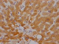 RBP4/Retinol-Binding Protein 4 Antibody (9G7), Novus Biologicals 50 &mu;L;