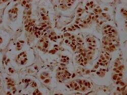 RBBP4/RbAp48 Antibody (3E9), Novus Biologicals 50 &mu;L; Unconjugated:Antibodies,