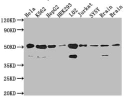 RBBP4/RbAp48 Antibody (3E9), Novus Biologicals 50 &mu;L; Unconjugated:Antibodies,