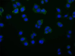 Rab25 Antibody (27H3), Novus Biologicals:Antibodies:Primary Antibodies