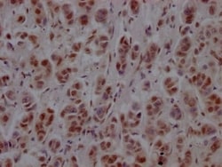 PTBP1 Antibody (8A1), Novus Biologicals:Antibodies:Primary Antibodies