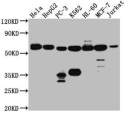 PTBP1 Antibody (8A1), Novus Biologicals:Antibodies:Primary Antibodies