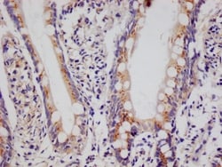 PA28 Activator alpha Subunit/PSME1 Antibody (29D5), Novus Biologicals:Antibodies:Primary
