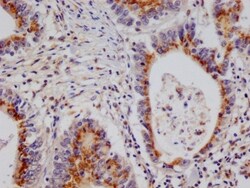 PA28 Activator alpha Subunit/PSME1 Antibody (29D5), Novus Biologicals:Antibodies:Primary