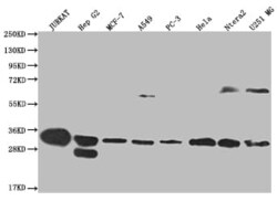 PA28 Activator alpha Subunit/PSME1 Antibody (29D5), Novus Biologicals:Antibodies:Primary