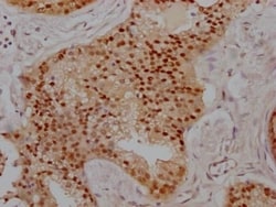 PRMT5 Antibody (2H4), Novus Biologicals:Antibodies:Primary Antibodies