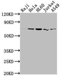 PRMT5 Antibody (2H4), Novus Biologicals:Antibodies:Primary Antibodies