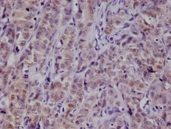 PKN2 Antibody (20A8), Novus Biologicals:Antibodies:Primary Antibodies