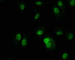 PKN2 Antibody (20A8), Novus Biologicals:Antibodies:Primary Antibodies