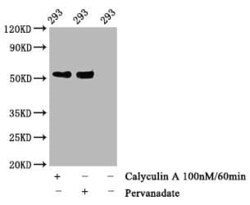 p53, p Thr55 Antibody (3C3), Novus Biologicals:Antibodies:Primary Antibodies