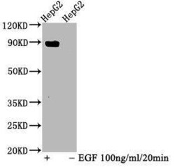 STAT5A, p Tyr694 Antibody (3F1), Novus Biologicals:Antibodies:Primary Antibodies