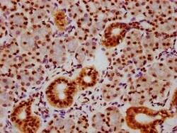 Smad5, p Ser463, p Ser465 Antibody (2G11), Novus Biologicals:Antibodies:Primary