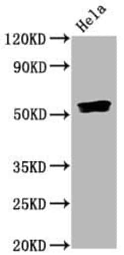 Smad5, p Ser463, p Ser465 Antibody (3A9), Novus Biologicals:Antibodies:Primary