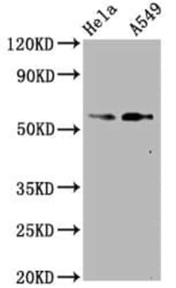 Smad2, p Ser250 Antibody (4D12), Novus Biologicals:Antibodies:Primary Antibodies