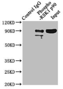 RSK1, p Thr359, p Ser363 Antibody (1B6), Novus Biologicals 100 &mu;L; Unconjugated:Antibodies,