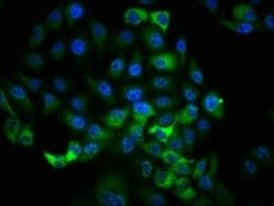 RSK1, p Thr359, p Ser363 Antibody (1B6), Novus Biologicals 100 &mu;L; Unconjugated:Antibodies,