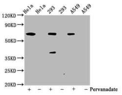 SHP-2/PTPN11, p Tyr542 Antibody (2E2), Novus Biologicals 100 &mu;L; Unconjugated:Antibodies,