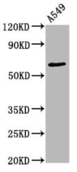 PKC zeta, p Thr560 Antibody (1B10), Novus Biologicals:Antibodies:Primary
