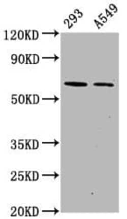 AMPK alpha 2, p Ser491 Antibody (3H10), Novus Biologicals:Antibodies:Primary
