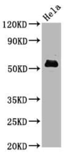 c-Myc, p Ser62 Antibody (2A10), Novus Biologicals:Antibodies:Primary Antibodies