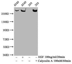 TOR/mTOR, p Ser2481 Antibody (3H11), Novus Biologicals:Antibodies:Primary