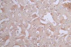 Tau, p Ser404 Antibody (11H10), Novus Biologicals:Antibodies:Primary Antibodies