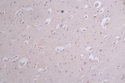 Tau, p Ser214 Antibody (31B12), Novus Biologicals 50 &mu;L; Unconjugated:Antibodies,