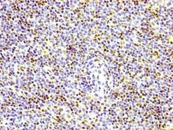 Histone H1.4, p Thr17 Antibody (3E1), Novus Biologicals:Antibodies:Primary