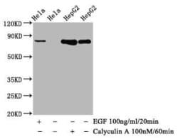 Glycogen Synthase, p Ser641 Antibody (1D1), Novus Biologicals:Antibodies:Primary