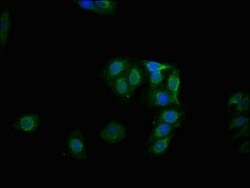 Glycogen Synthase, p Ser641 Antibody (1D1), Novus Biologicals:Antibodies:Primary