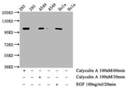 IRE1 alpha, p Ser724 Antibody (1F12), Novus Biologicals:Antibodies:Primary