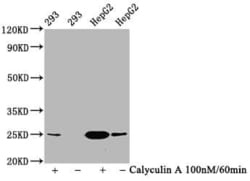 eIF4E, p Ser209 Antibody (1F3), Novus Biologicals:Antibodies:Primary Antibodies