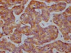 eIF2 alpha/EIF2S1, p Ser51 Antibody (1C6), Novus Biologicals:Antibodies:Primary