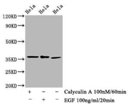 eIF2 alpha/EIF2S1, p Ser51 Antibody (1C6), Novus Biologicals:Antibodies:Primary